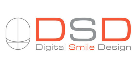 digital smile design