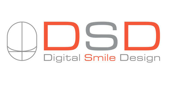 digital-smile-design-dsd-540x280 digital smile design
