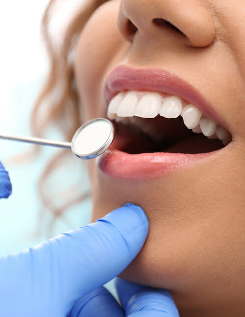 dental cleanings