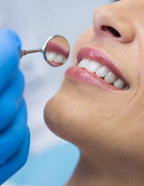 non-surgical small mirror