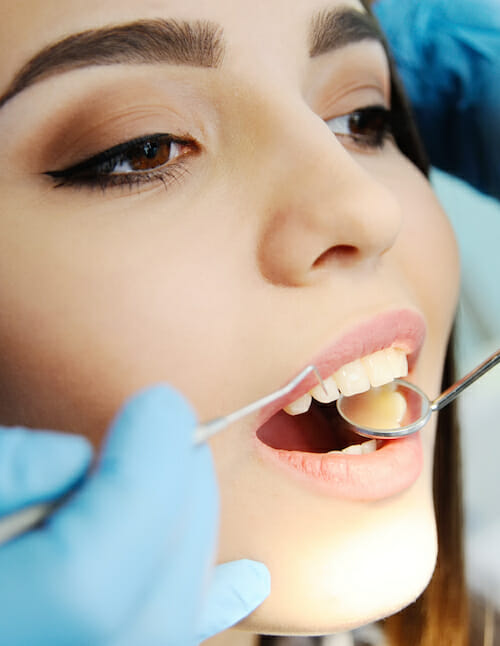 tooth colored teeth cleaning