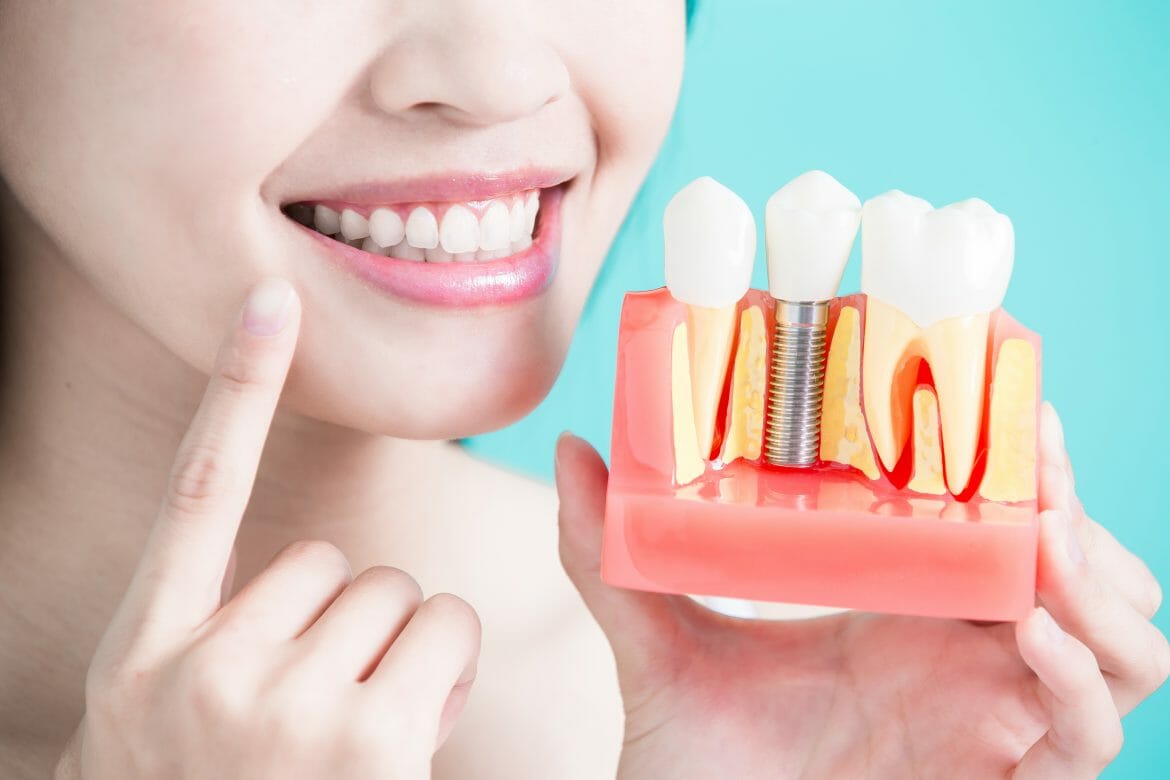 Physical Diagram of Teeth and Gums