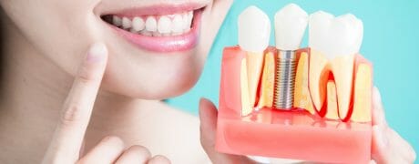 Physical Diagram of Teeth and Gums