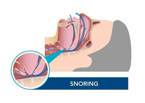 Illustration_snoring