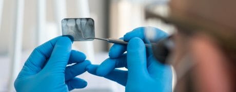 What's the Difference Between an Endodontist and a Dentist
