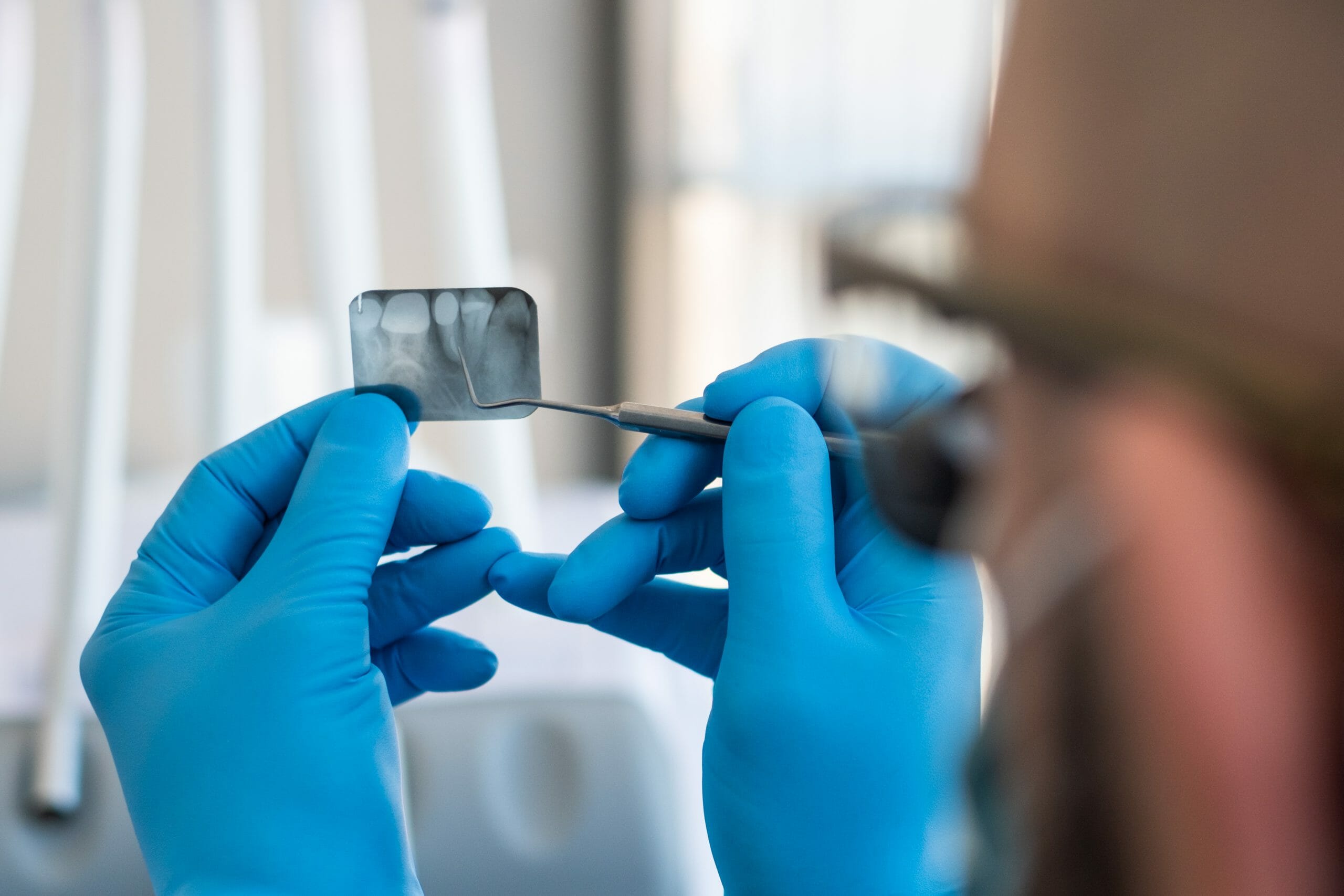 Endodontist vs. a Dentist