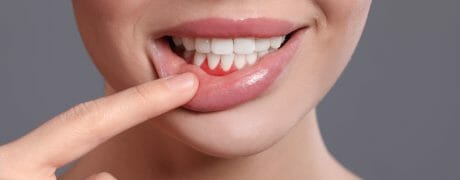 Girl showing off her clean teeth