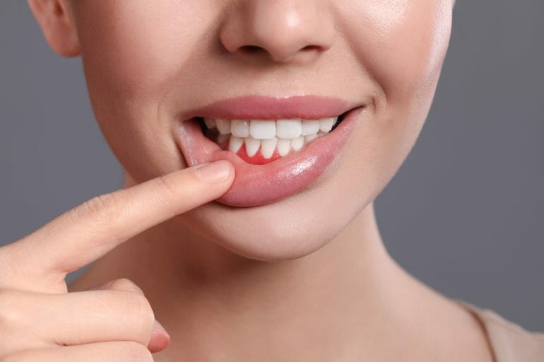 Girl showing off her clean teeth