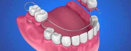 animated partial denture