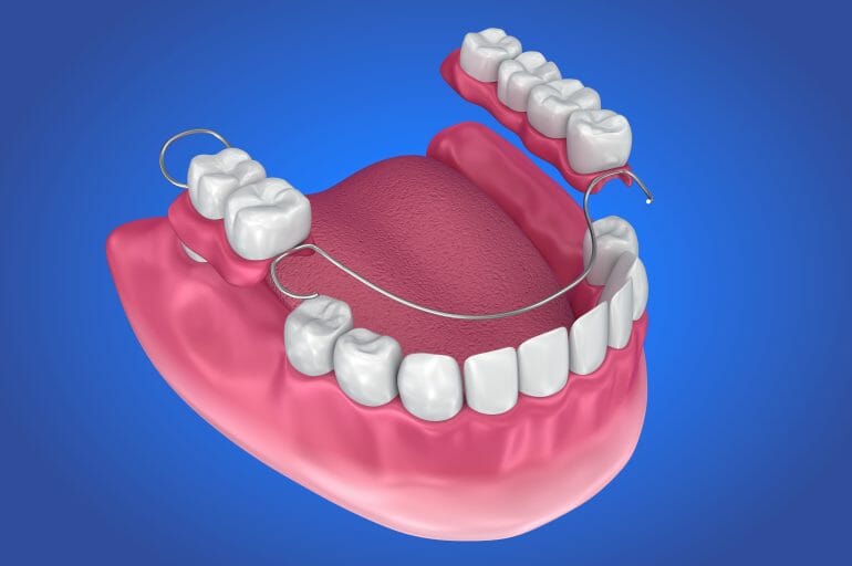 animated partial denture